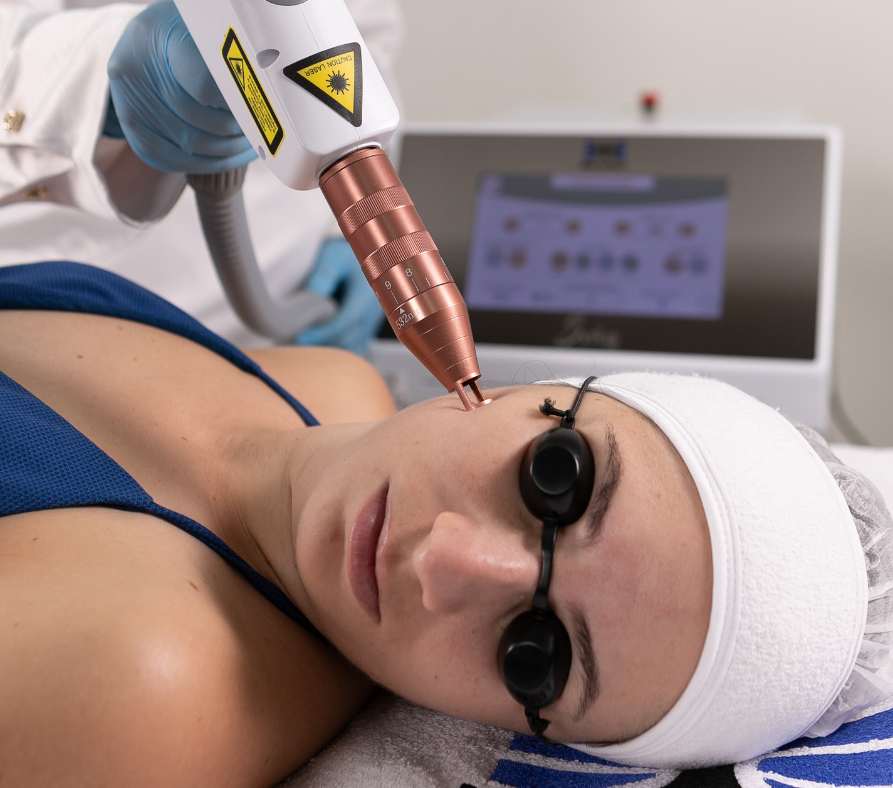 Aparelho de Estética Ibramed - Laser ND:Yag Q-Switched