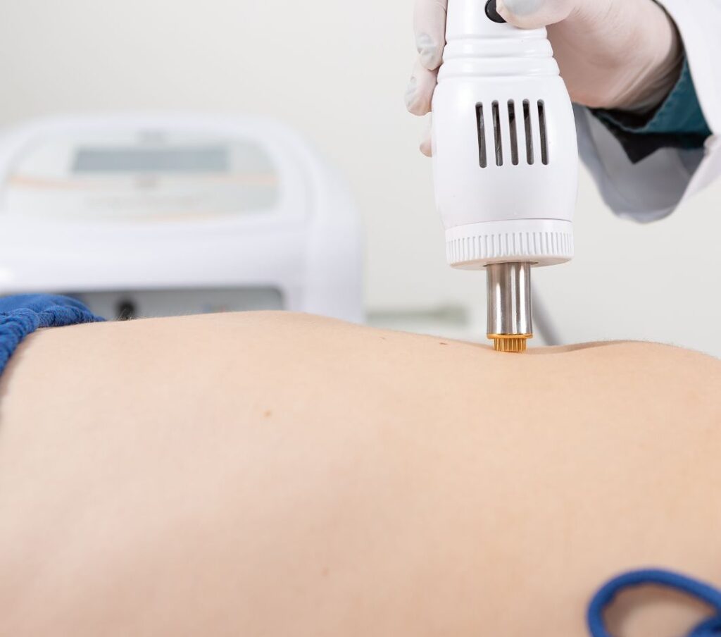 Criofrequência Fracionada não invasiva e ablativa