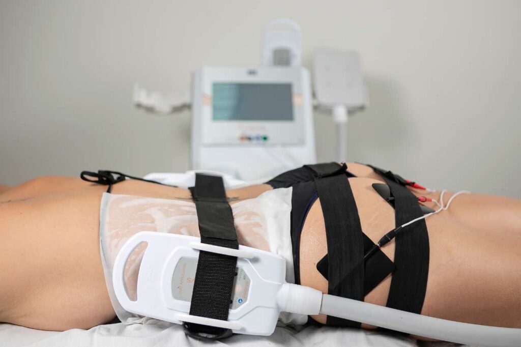 Medicina Estética - Criolipólise de Placas com eletroestimulação