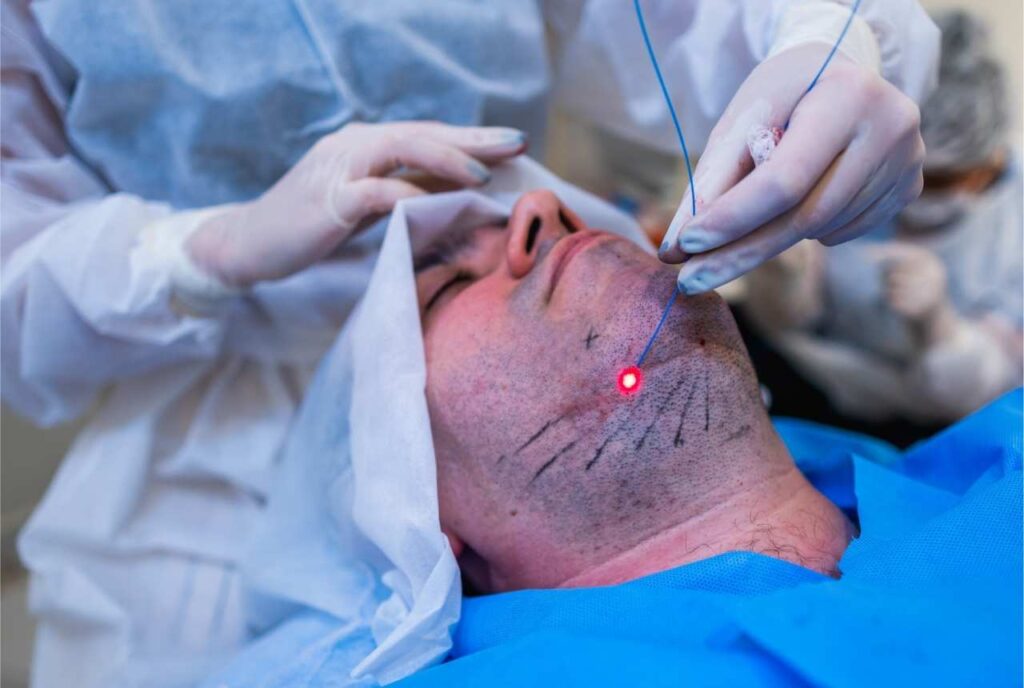 endolaser equipamento médico - Tratamento para redução de gordura localizada na papada