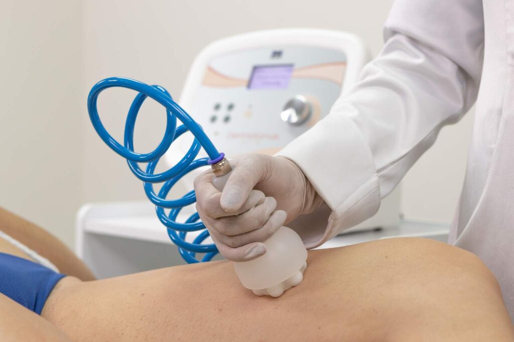 Estética Corporal - Endermoterapia para tratamento de celulite