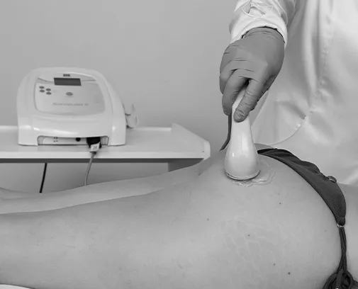 Estética Corporal - Sonopulse III Ibramed