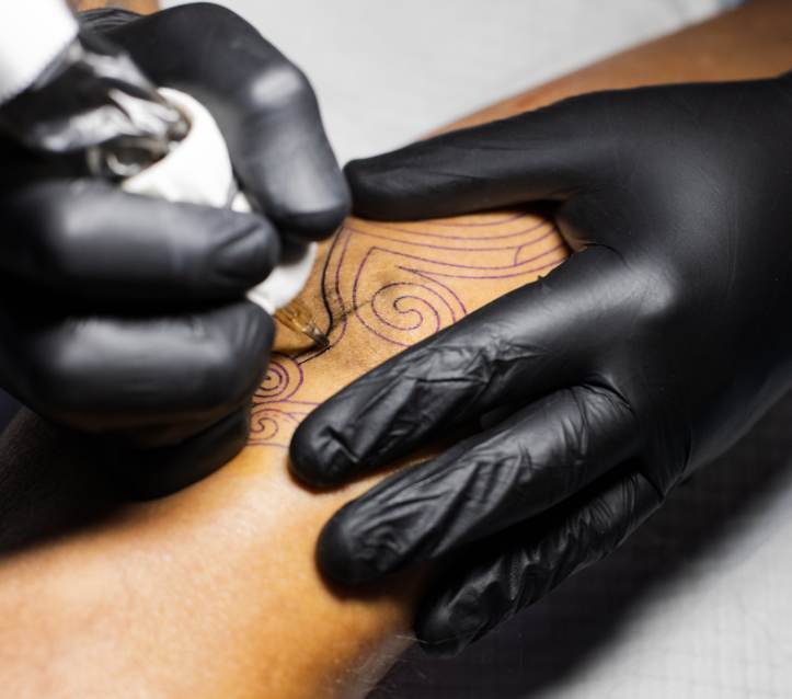 Remoção de tatuagem a laser: o poder de apagar para criar novos traços